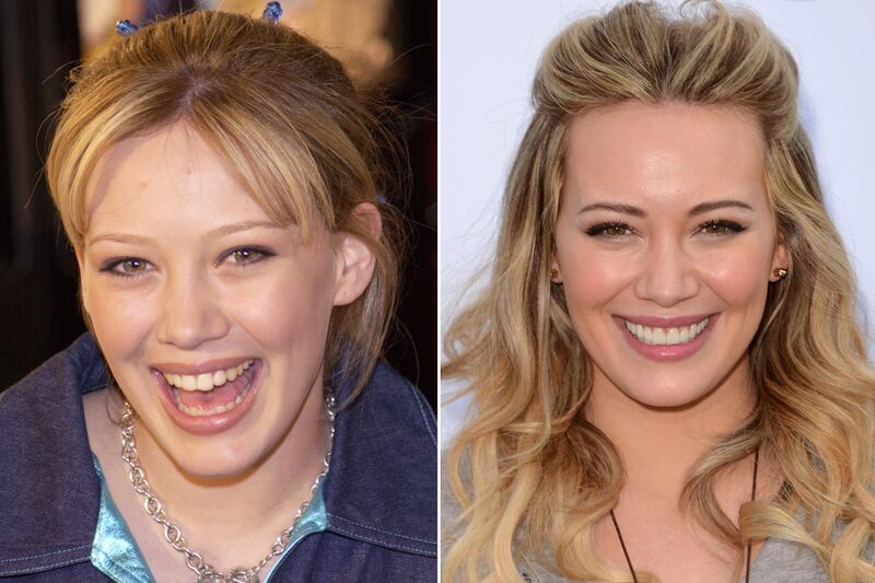 galleries/2012/06/08/jewel-lindsay-lohan-more-stars-who-fixed-their-teeth-photos/celebrity-teeth-fixers-duff_fyld2h