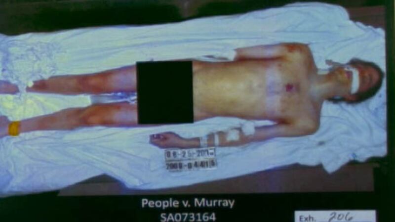 articles/2011/10/12/michael-jackson-trial-propofol-pills-conrad-murray/michael-jackson-autopsy-photo-embed_bdnspd