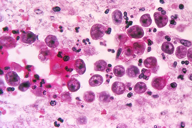 articles/2011/12/23/brain-eating-amoeba-cases-puzzle-and-worry-scientists/neti-pots-amoeba-begley_ey9owc