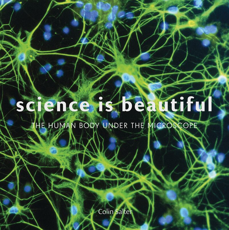 galleries/2015/02/02/a-way-too-close-look-at-the-human-body/150130-science-beautiful-cover_sgrxiw