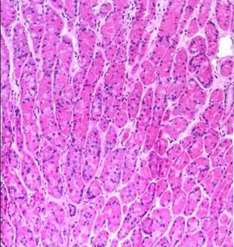 interstitial interstitium new organ anatomy body neil theise carr-locke benias human microscope liver pathology endoscopy pathologist endoscopist new york university scientific report