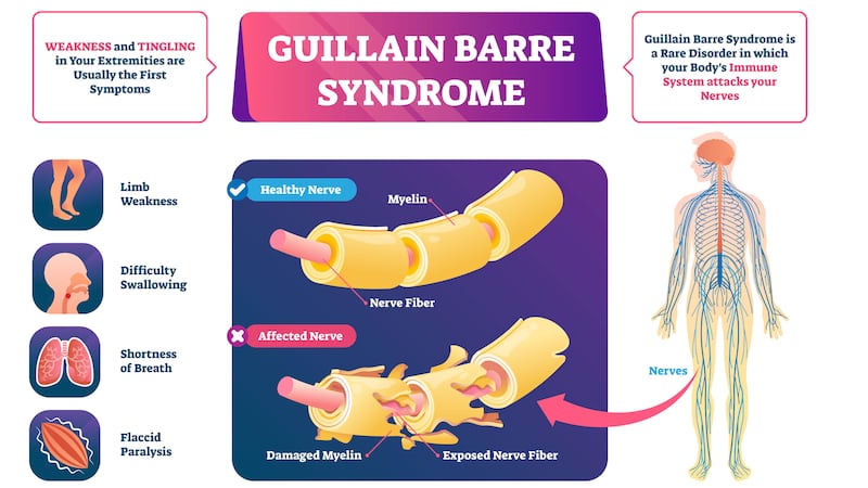 200707-The-Conversation-Guillain-Barre_Syndrome-covid-embed_vutl3z