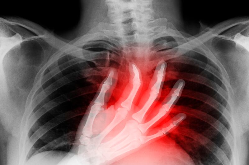 articles/2014/04/25/scientists-at-johns-hopkins-come-closer-to-eliminating-heart-disease/140424-eisinger-heartattack-tease_lhdkcu