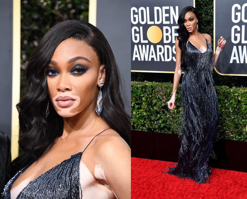 globes-winnie-harlow_zwinmc