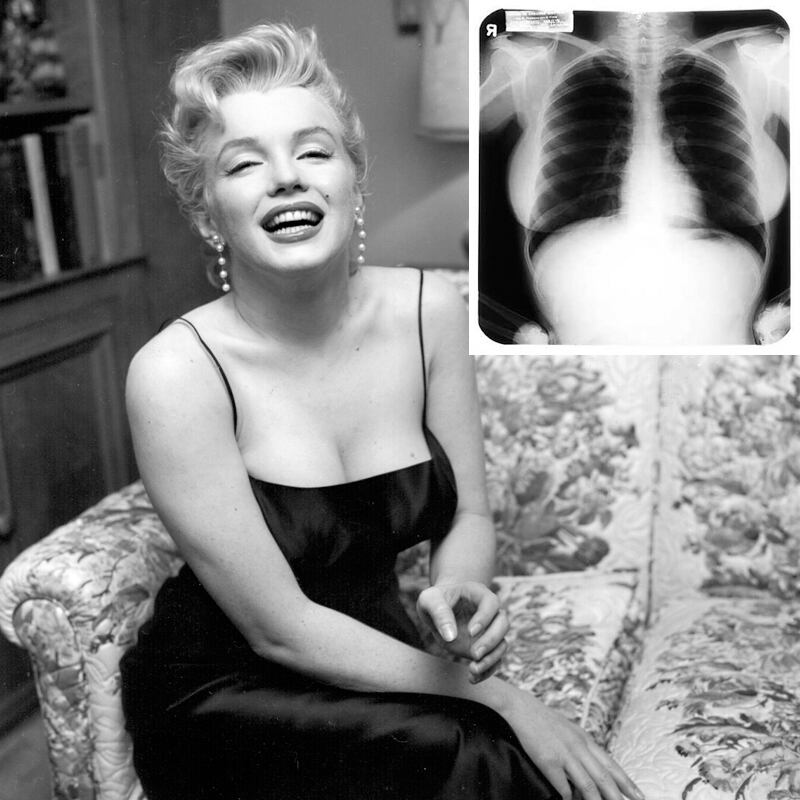 galleries/2011/09/26/marilyn-monroe-auctions-jfk-dress-photos-piano-movie-gown-more/mariklyn-monroe-auction-xray_nlcpwt