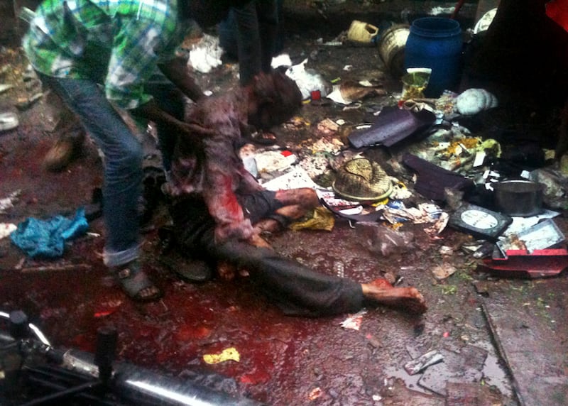 galleries/2011/07/13/mumbai-blasts-shocking-photos/mumbai-bombing7_h6gagg