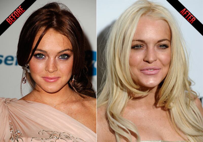 galleries/2010/07/19/too-young-for-botox/too-young-for-botox---lohan_diui2y