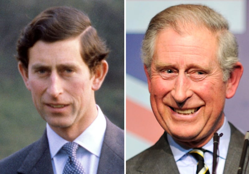 galleries/2011/04/25/bald-royals/bald-royals---prince-charles_bfyg3u