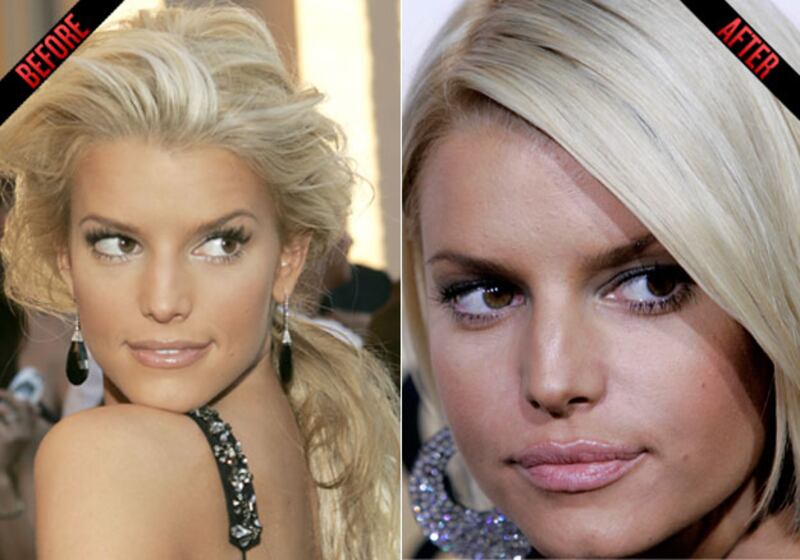 galleries/2010/07/19/too-young-for-botox/too-young-for-botox---jessica-simpson_qrnlja