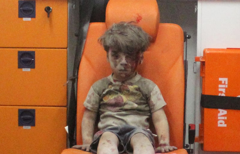 articles/2017/04/07/trump-just-discovered-the-slaughter-of-syria-s-beautiful-babies/170407-syria-children-Omran-Daqneesh_netda7