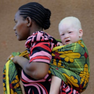 articles/2010/08/27/juju-chang-albino-crimes-seeing-improvement-in-africa/chang-albino-murders_122696_llbubm