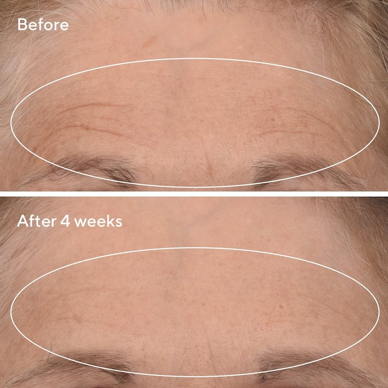 Murad Retinal Resculpt before and after