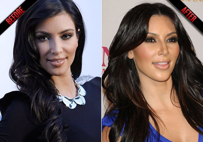 galleries/2010/07/19/too-young-for-botox/too-young-for-botox---kardashian_oqn5ub