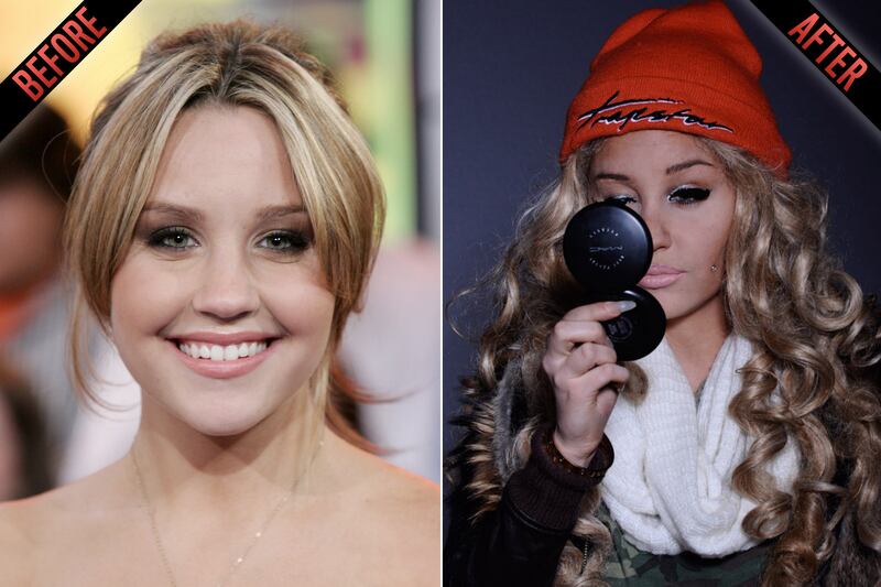 galleries/2010/07/19/too-young-for-botox/too-young-for-botox---amanda-bynes_fpe1kv