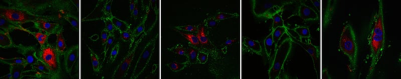 Slide_5_transient_reprogramming_partially_restores_collagen_nzp0ro