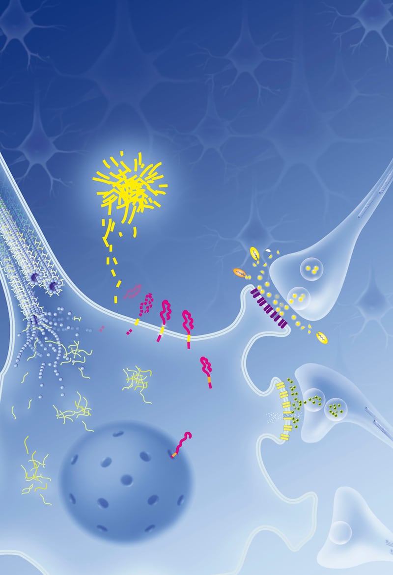 A colored image showing how brain cells are affected by amyloid protein buildup.