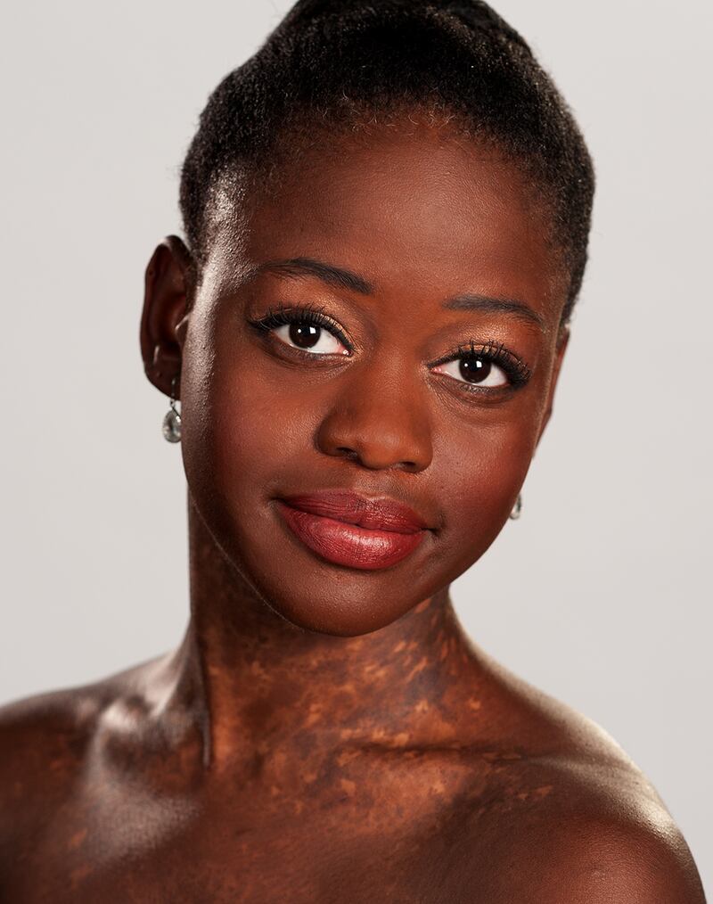 galleries/2013/03/28/women-in-the-world-2013-speakers-list-photos/130327-michaela-deprince_ubpmgw