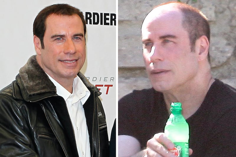 galleries/2011/09/27/stars-who-suddenly-have-hair-travolta-costner-alexander-cryer-photos/stars-who-suddenly-have-hair-gal-travolta_w1t3hx