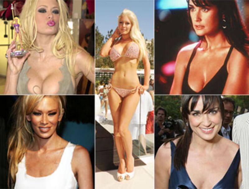 articles/2010/08/25/breast-implant-removal-heidi-montag-more-plastic-surgery-regrets/great-deflation_122209_kohsl2