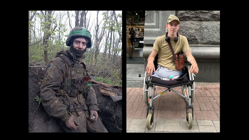 A photo illustration showing Vova Prostokyshin before and after he lost his legs battling Russian soldiers in Ukraine