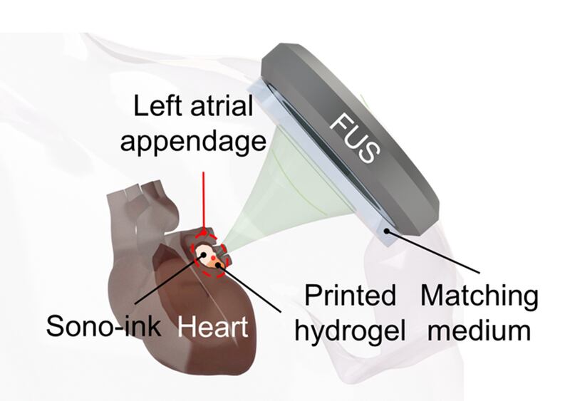 A photo including a 3D printed organ