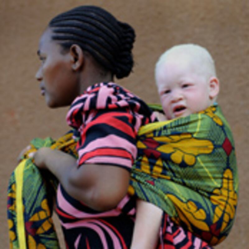 articles/2010/08/27/juju-chang-albino-crimes-seeing-improvement-in-africa/chang-albino-murders_122696_zsxvi4