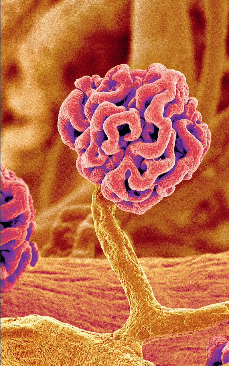 galleries/2015/02/02/a-way-too-close-look-at-the-human-body/150130-science-beautiful-kidney-glomerulus_pudb2y