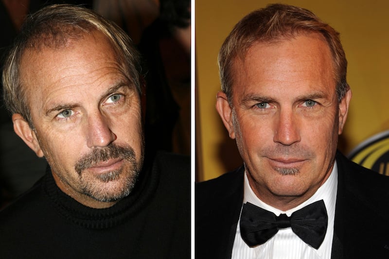 galleries/2011/09/27/stars-who-suddenly-have-hair-travolta-costner-alexander-cryer-photos/stars-who-suddenly-have-hair-gal-costner_z0dlbv