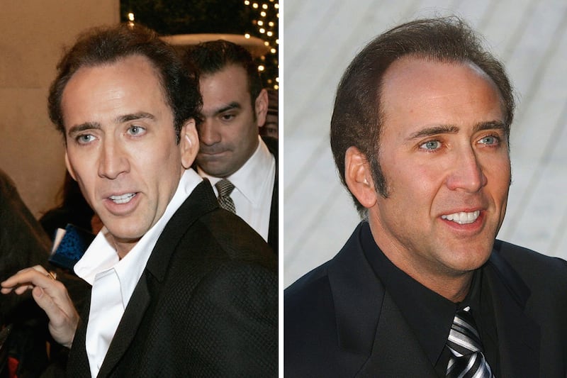 galleries/2011/09/27/stars-who-suddenly-have-hair-travolta-costner-alexander-cryer-photos/stars-who-suddenly-have-hair-gal-cage_qbfxiw