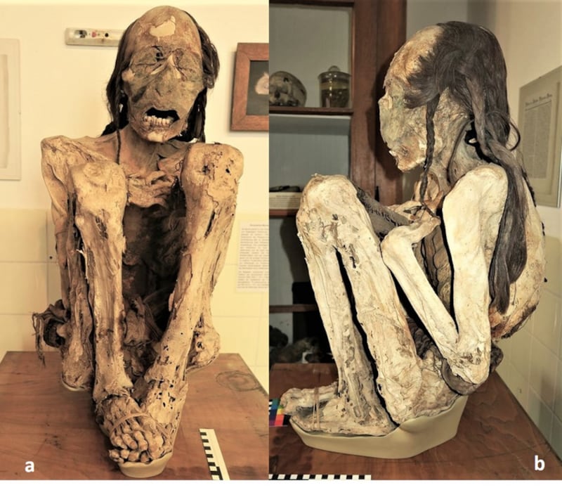 Low-Res_frontiers-medicine-south-american-mummies-1.JPEG_1_y9fizd