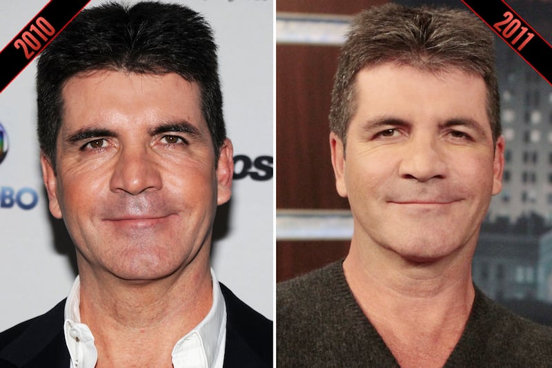 galleries/2011/10/05/simon-cowell-steve-martin-male-stars-rumored-plastic-surgery-photos/plastic-surgery-simon-cowell-2_lau6yn