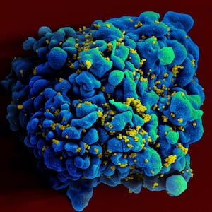 hiv_cell_zaeykn