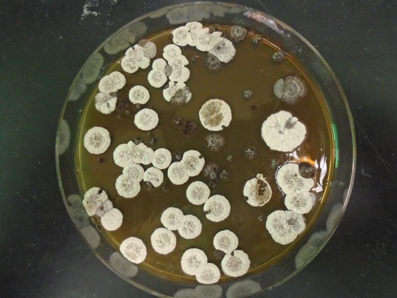 Low-Res_The_common_bacteria_streptomyces_which_makes_the_cyclopropane-containing_molecules_CREDIT_Pablo_Morales-Cruz_1.JPG_gzhrwv