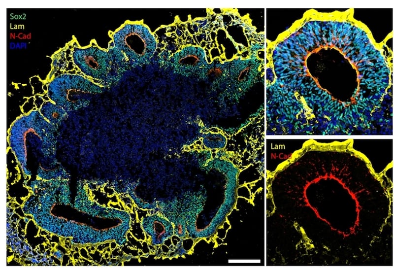 Image_1_brain_organoids_structure__c_Novarino_group_ISTA_copy_hfkm8f