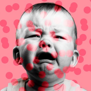 image of crying baby with pink background and darker spots all over measles rockland county new york unvaccinated minors antivaxxer anti vaxxer easter passover