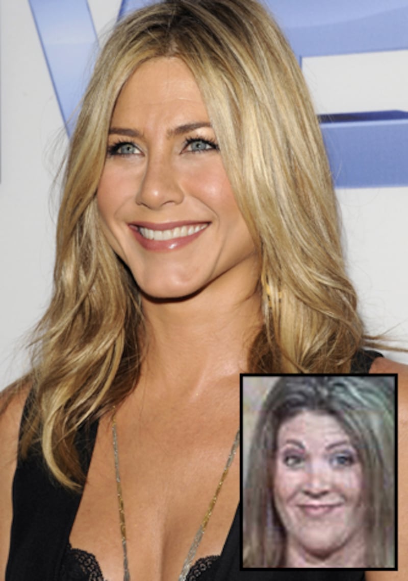 galleries/2011/10/16/superman-jennifer-aniston-brad-pitt-cher-plastic-surgery-look-alikes/plastic-surgery-jennifer-aniston_ryb7m7