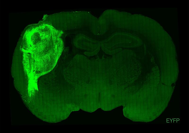 A_transplanted_human_organoid_labeled_with_a_fluorescent_protein_in_a_section_of_the_rat_brain..image-jpeg_fzwvhv