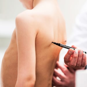 Physical therapist examining posture of a little boy, making marks on his back, checking angles of scapula bones afm acute flaccid myelitis colorado minnesota cdc centers for disease control panic