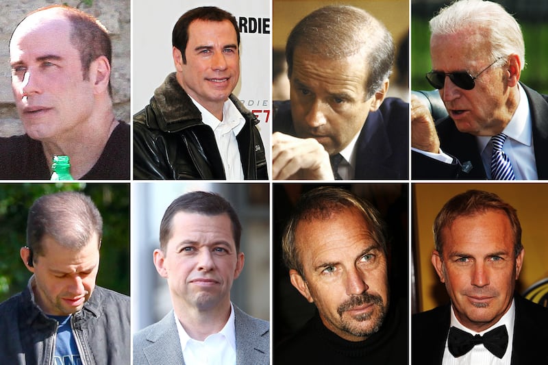 galleries/2011/09/27/stars-who-suddenly-have-hair-travolta-costner-alexander-cryer-photos/stars-who-suddenly-have-hair-gal-tease_zdne2i