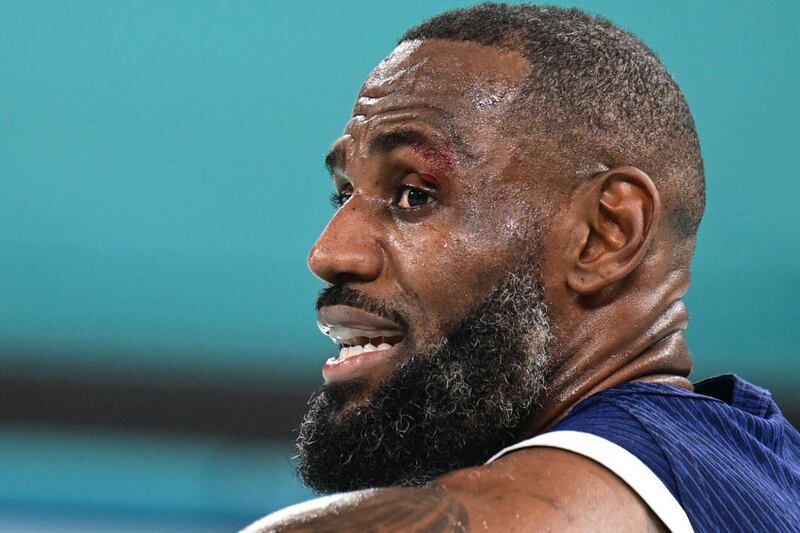 LeBron James sports a gash just above his left eye.