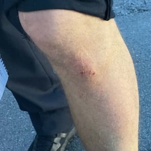 Side-by-side photos of a scraped knee and ripped pants of a Louisville cop.