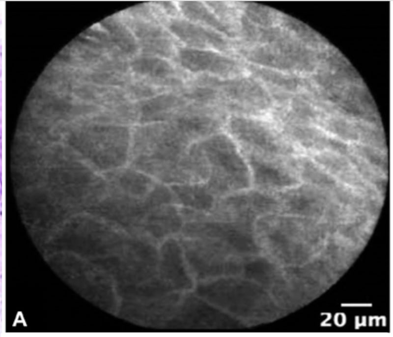 interstitial interstitium new organ anatomy body neil theise carr-locke benias human microscope liver pathology endoscopy pathologist endoscopist new york university scientific report