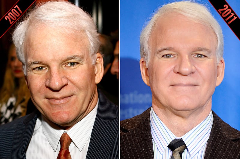 galleries/2011/10/05/simon-cowell-steve-martin-male-stars-rumored-plastic-surgery-photos/plastic-surgery-steve-martin-2_gjw5n9